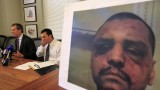la-me-ln-jail-visitor-beating-settlement-20140-001